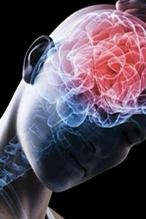 Traumatic Brain Injury (TBI)