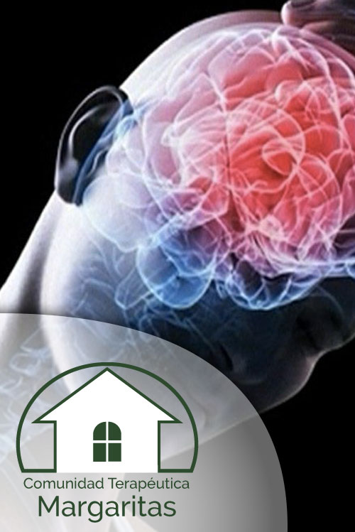 Daño Cerebral Orgánico